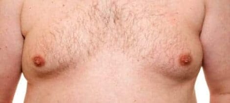 Image: Close-up of a male torso showing a bare chest with moderate hair, two nipples, and some freckles against a white background. -- D.C. Douglas